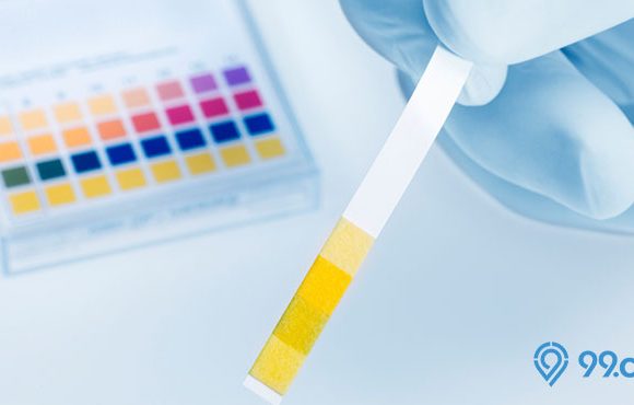 arti warna urine