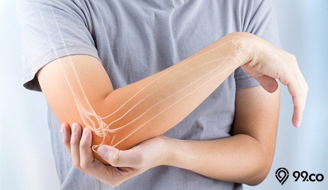 osteoporosis tulang anak muda
