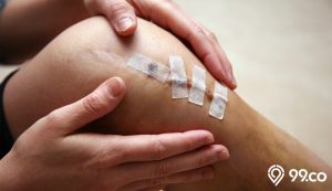 cara menghilangkan bekas luka dengan bahan alami